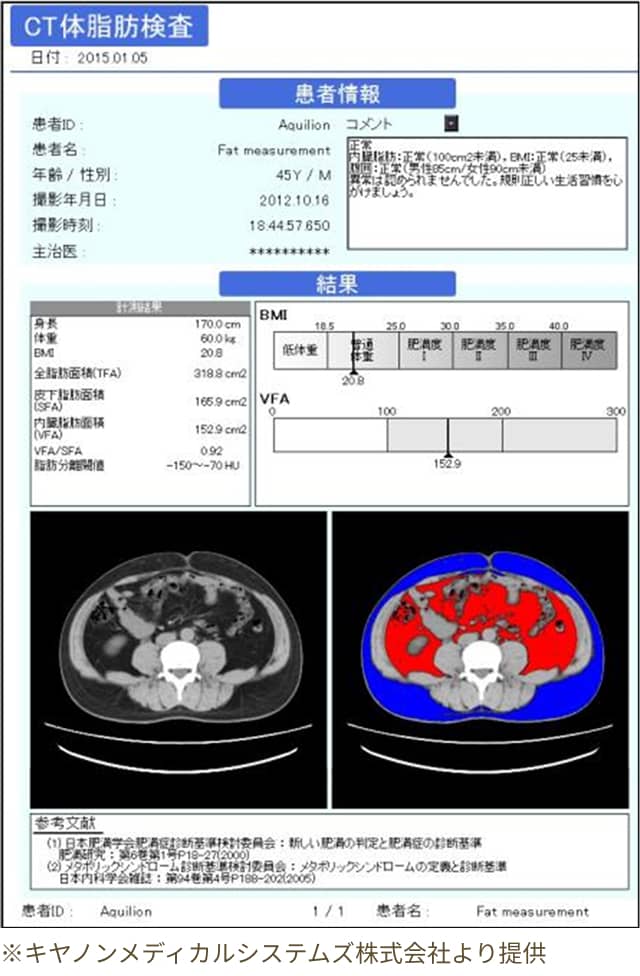 脂肪測定CTプラン